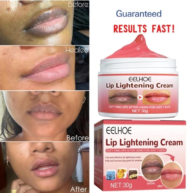Lip Whitening for Dark Lips